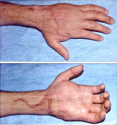 z-Hands photo z-Hands_zps3ed3a49d.jpg