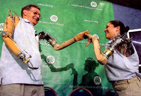 z-BionicArms photo z-BionicArms_zps20ad04f7.jpg