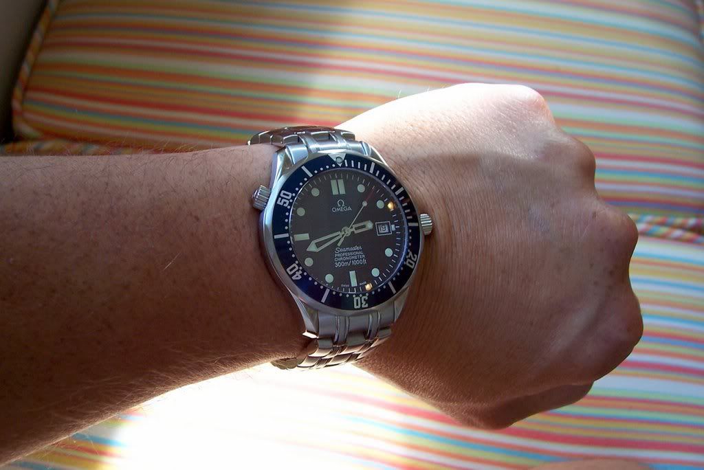 smpbondwrist.jpg
